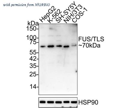 HUABIO ET1701-86 image 1