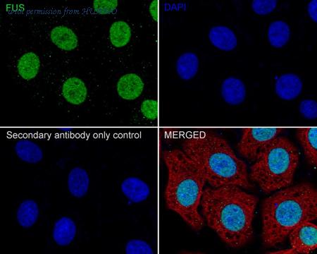 HUABIO ET1701-86 image 2