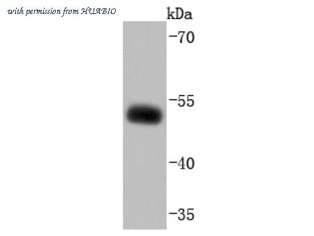 HUABIO ET1701-96 image 1
