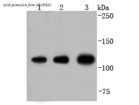 HUABIO ET1701-97 image 2