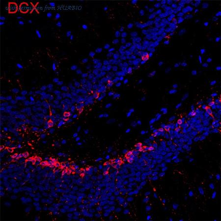 HUABIO ET1701-98 image 2