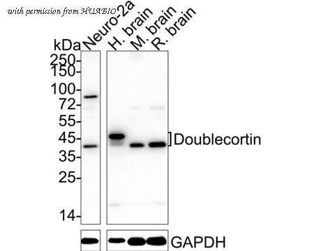HUABIO ET1701-98 image 3