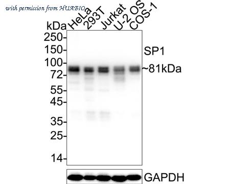 HUABIO ET1702-02 image 1