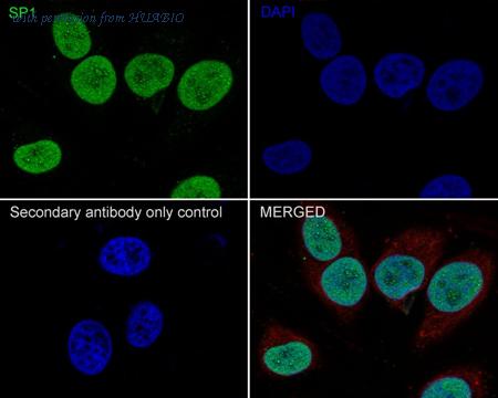 HUABIO ET1702-02 image 2