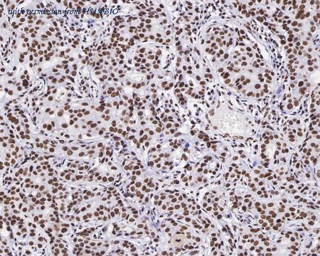 HUABIO ET1702-02 image 3