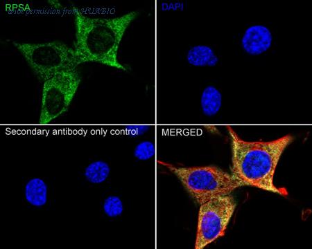 HUABIO ET1702-05 image 3