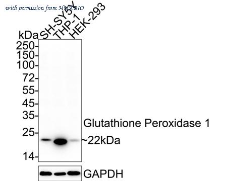 HUABIO ET1702-09 image 1