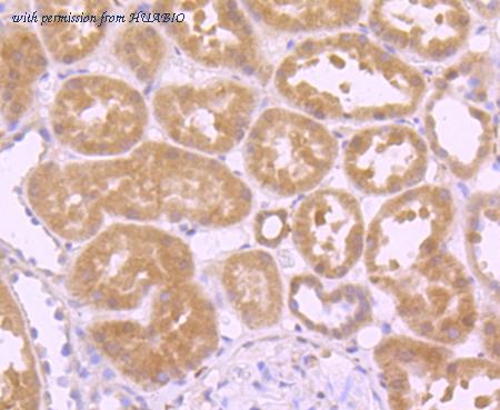 HUABIO ET1702-09 image 3