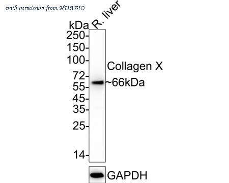 HUABIO ET1702-13 image 1