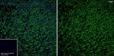 HUABIO ET1702-15 image 3