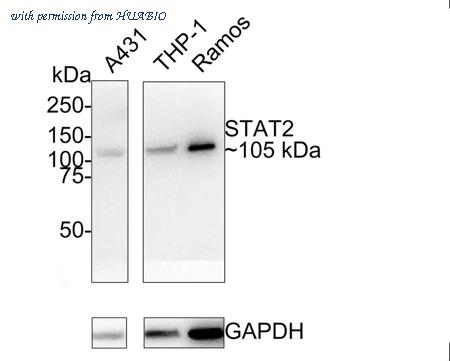 HUABIO ET1702-18 image 1