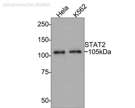 HUABIO ET1702-18 image 2