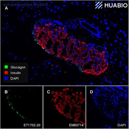 HUABIO ET1702-20 image 1