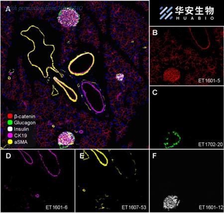 HUABIO ET1702-20 image 2