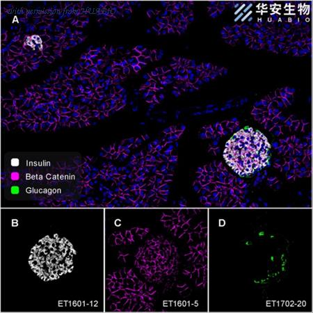 HUABIO ET1702-20 image 3