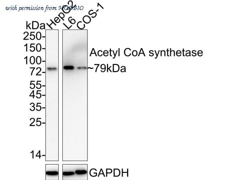 HUABIO ET1702-21 image 1