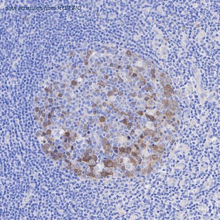 HUABIO ET1702-31 image 3