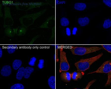 HUABIO ET1702-32 image 2
