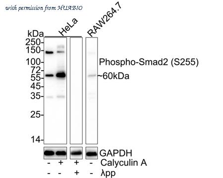 HUABIO ET1702-34 image 1