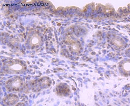 HUABIO ET1702-34 image 2