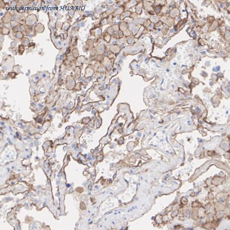 HUABIO ET1702-38 image 3