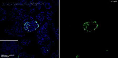 HUABIO ET1702-59 image 1