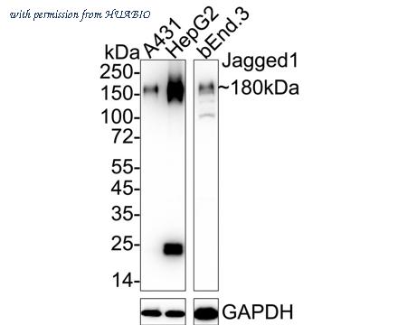 HUABIO ET1702-63 image 1