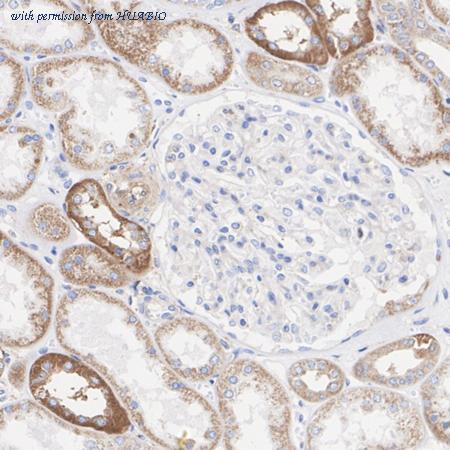 HUABIO ET1702-63 image 2