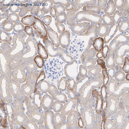 HUABIO ET1702-63 image 3