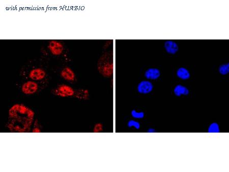 HUABIO ET1702-71 image 3