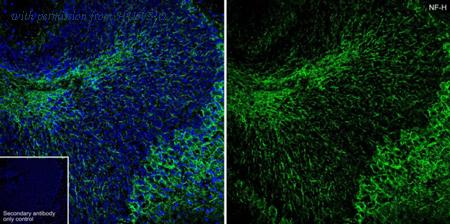 HUABIO ET1702-72 image 1