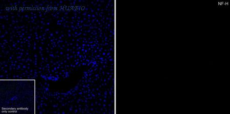 HUABIO ET1702-72 image 2