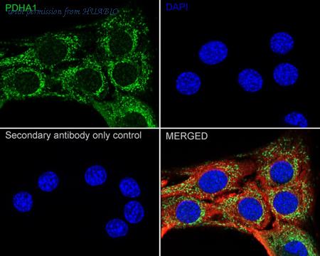 HUABIO ET1702-75 image 3