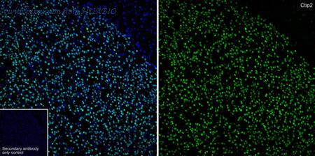 HUABIO ET1702-76 image 2