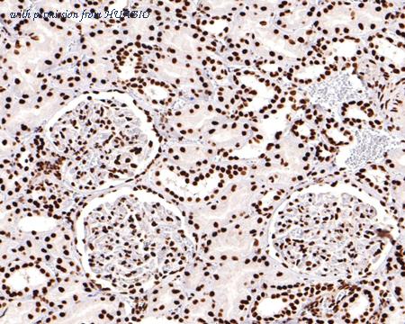 HUABIO ET1702-79 image 2