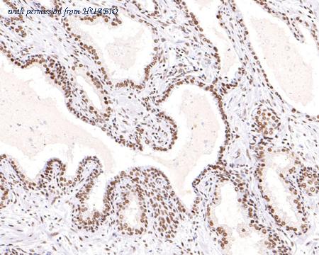 HUABIO ET1702-79 image 3