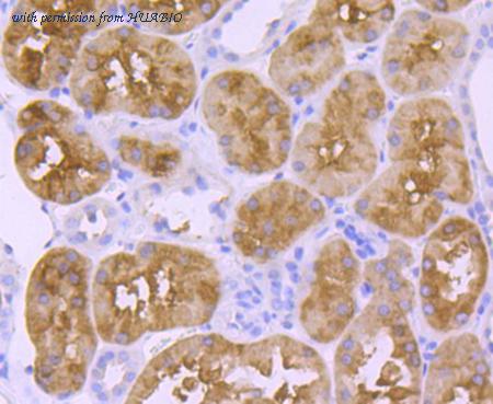 HUABIO ET1702-80 image 2