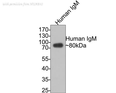 HUABIO ET1702-81 image 2