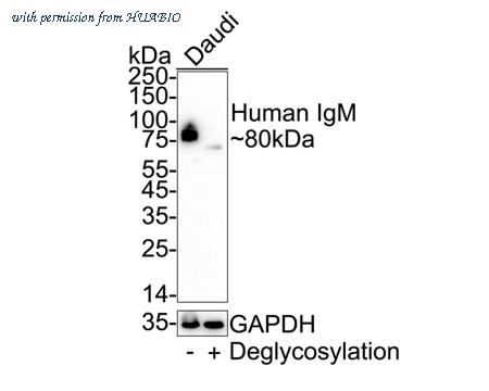 HUABIO ET1702-81 image 3