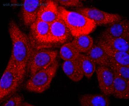 HUABIO ET1702-82 image 1