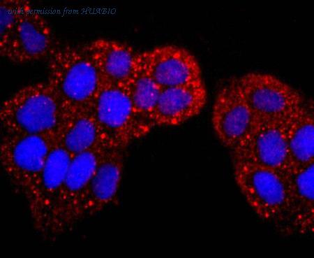 HUABIO ET1702-82 image 2