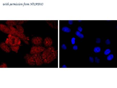 HUABIO ET1702-84 image 2