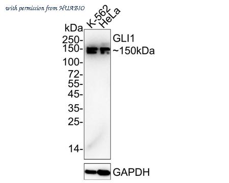 HUABIO ET1702-85-50UL image 1