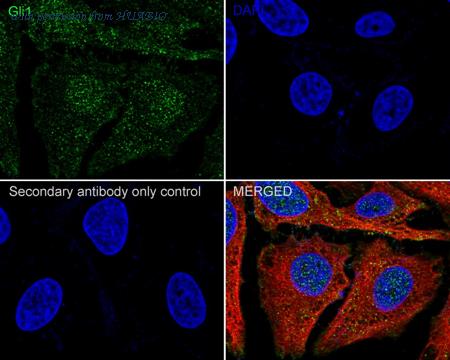 HUABIO ET1702-85-50UL image 3