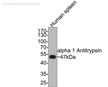 HUABIO ET1702-87 image 1