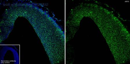 HUABIO ET1702-91 image 2