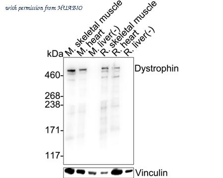 HUABIO ET1702-98 image 1