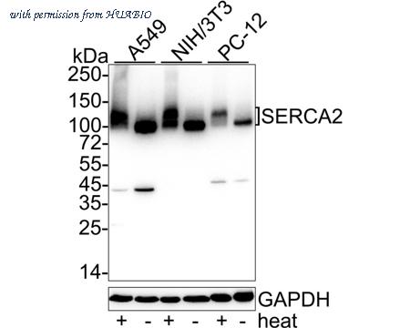 HUABIO ET1703-01 image 1