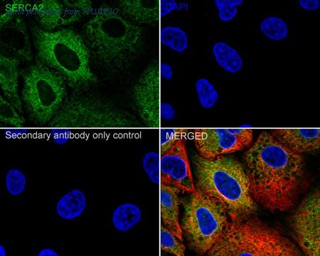 HUABIO ET1703-01 image 2
