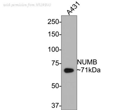 HUABIO ET1703-02 image 1